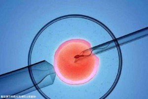 三代试管生儿子